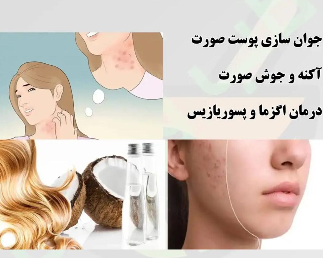 تهیه ماسک صورت با روغن نارگیل تهیه ماسک صورت با روغن نارگیل