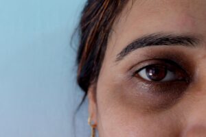 چه عواملی باعث سیاهی زیر چشم می شوند؟