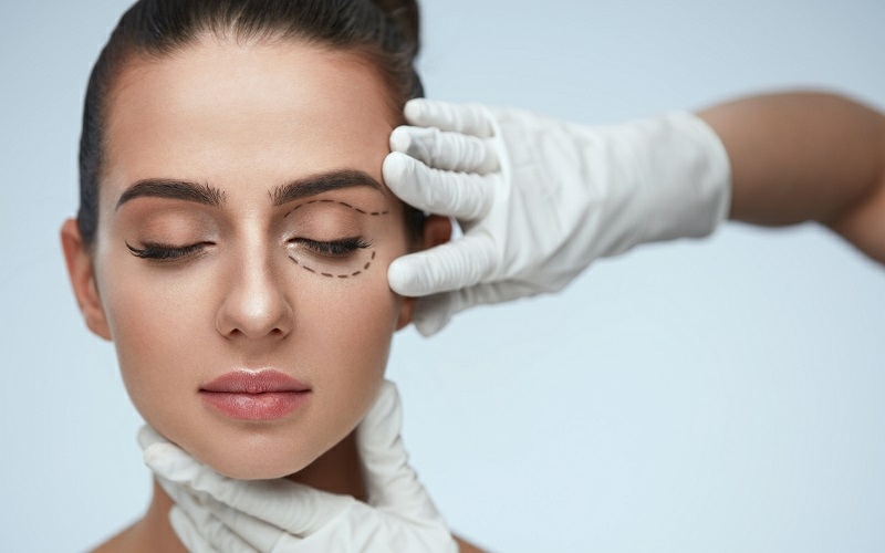 درمان افتادگی پلک با استفاده از فیلر