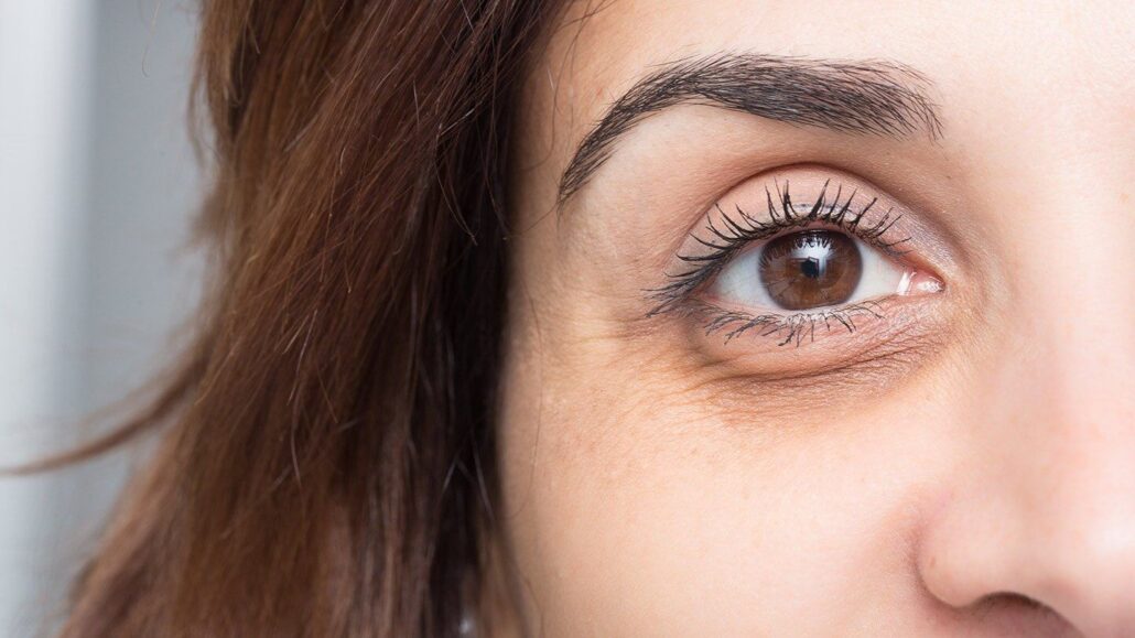 خوراکی برای بهبود سیاهی زیر چشم