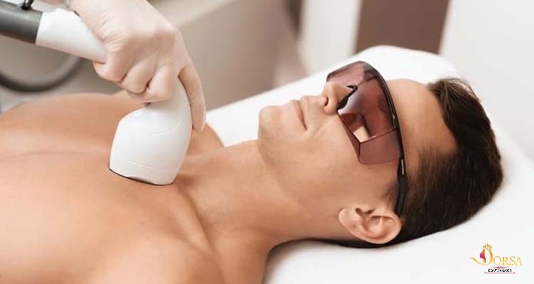 مراقبت های قبل از لیزر مو های زائد