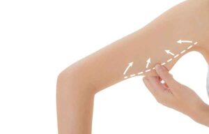 مراقبت های بعد از براکیوپلاستی