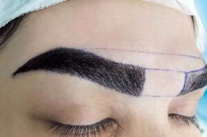 دلایل ریزش ابرو ها بعد از کاشت چیست؟