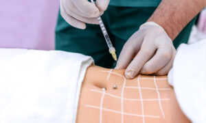 آیا تزریق چربی باعث جوش می شود؟