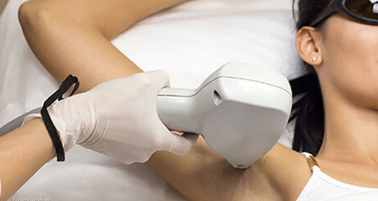 لیزر و زگیل تناسلی چه تاثیری بر روی هم دارند؟