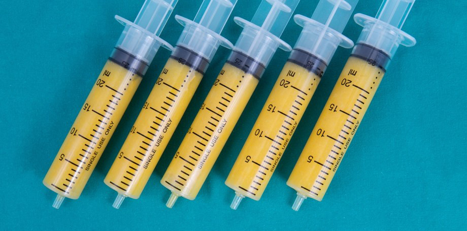 سن مناسب انتقال چربی و کانتورینگ صورت