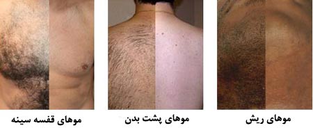 چگونه سن بر میزان رشد موی کمر تاثیر می گذارد؟