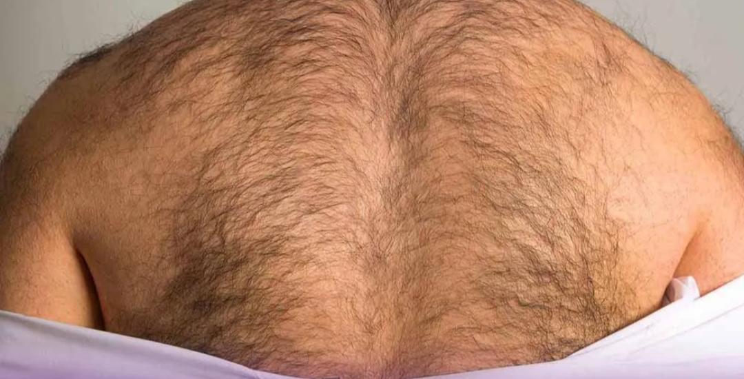 تاثیر عوامل ژنتیکی بر رویش مو در کمر مردان