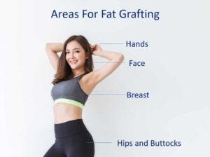 تزریق چربی برای چه نواحی مناسب است؟