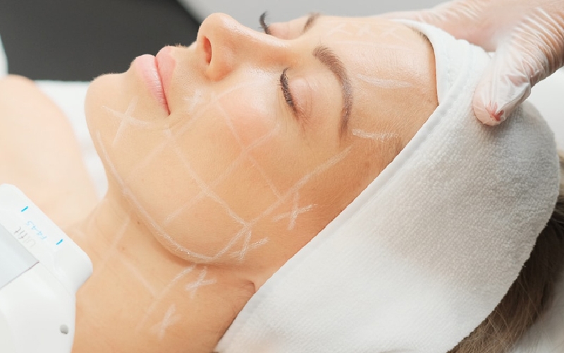 هایفوتراپی بهتر است یا مزوتراپی؟ ماندگاری کدامیک بیشتر است؟