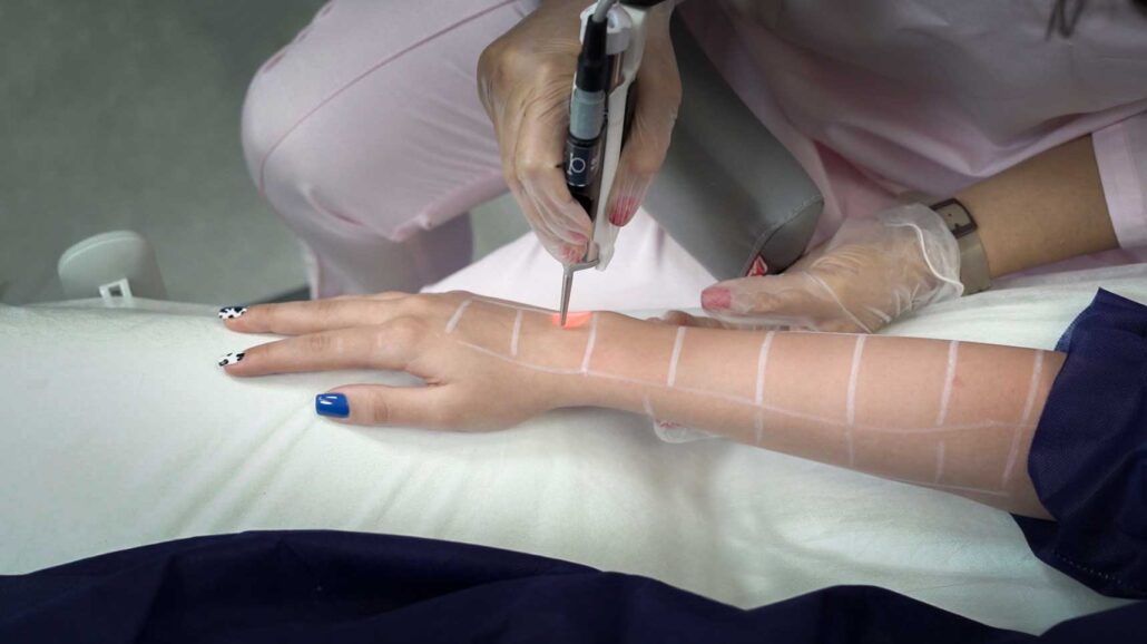  کاربرد دستگاه الیت پلاس چیست و چگونه عمل می کند؟