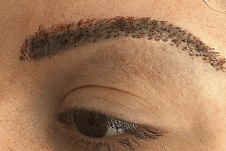 چرا چشمان ما بعد از کاشت ابرو ورم می کند؟