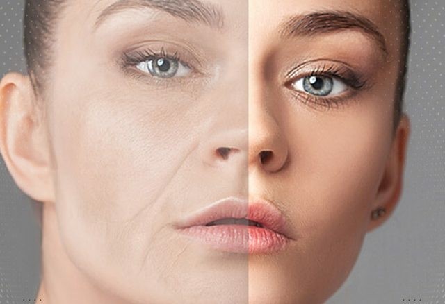 چگونه چربی به صورت ما تزریق می شود؟ 