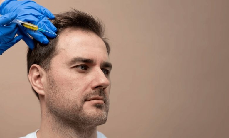 آیا از داروهای بیهوشی برای انجام مزوتراپی مو استفاده می شود!