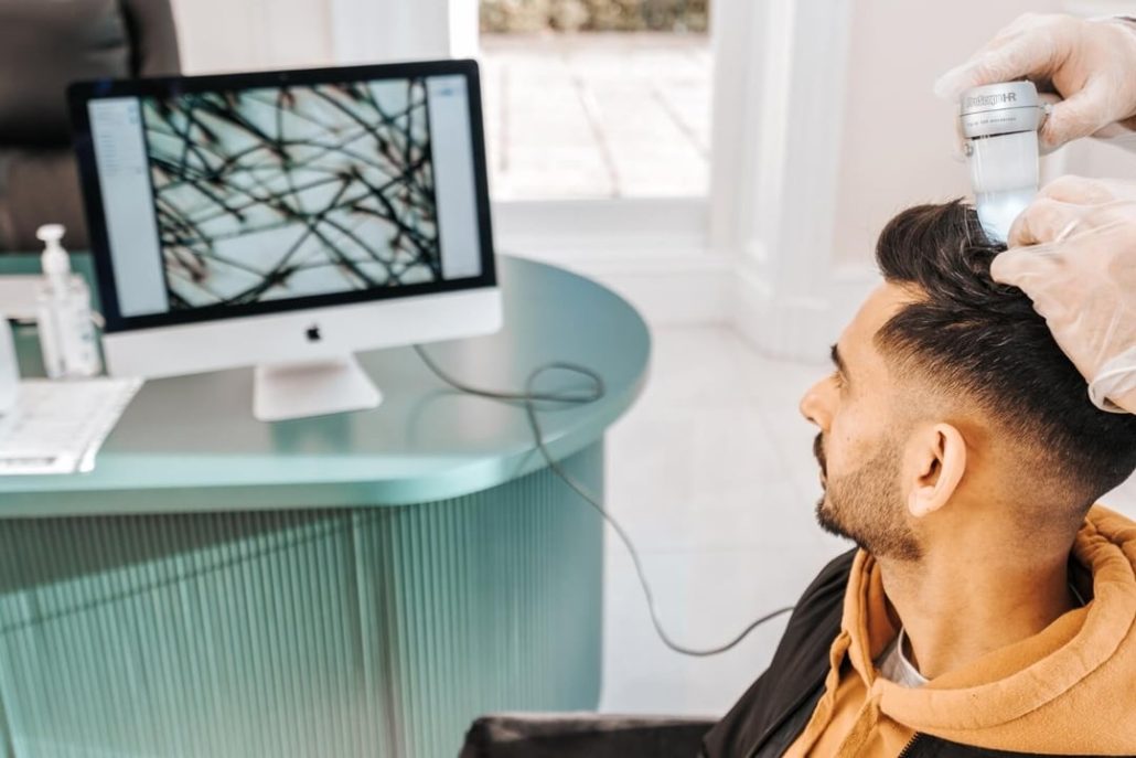 آیا مزوتراپی مو درد دارد؟