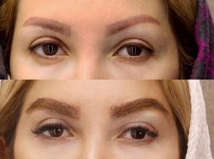 کاشت ابرو نیاز به ترمیم دارد؟