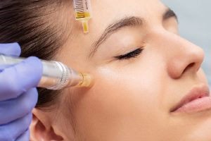 مهمترین تاثیر پی آر پی در جوانسازی