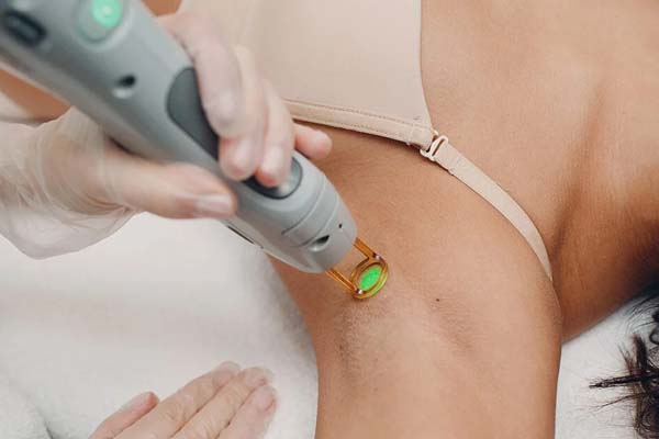 لیزر موهای زائد چیست؟