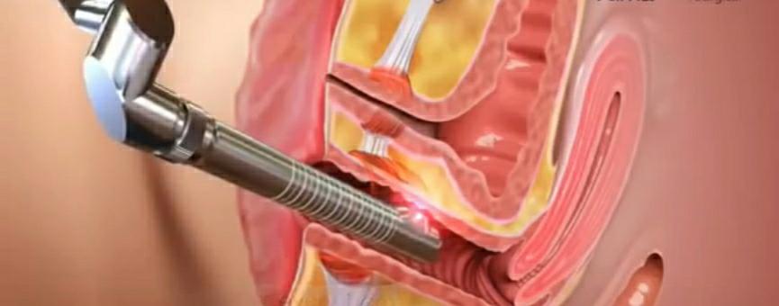 چه کسانی امکانِ استفاده از این دستگاه را ندارند؟