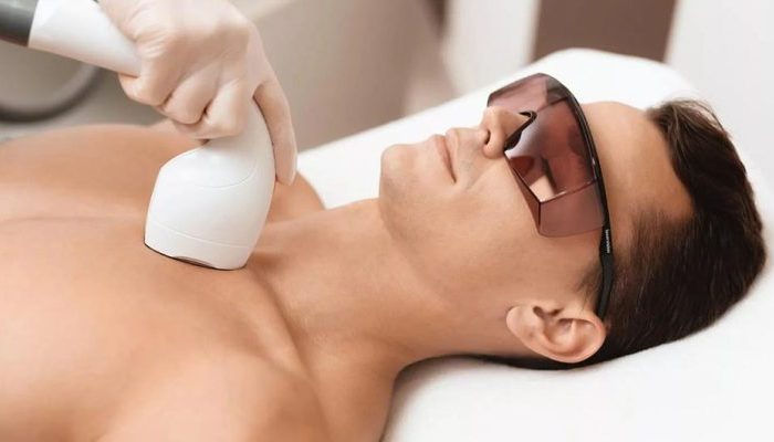 کاهش خطر ابتلا به سرطان پوست در اثر لیزر موهای زائد