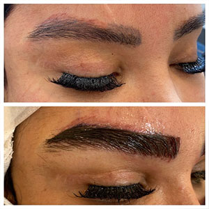 نکات مهم پیرو ترمیم کاشت ابرو