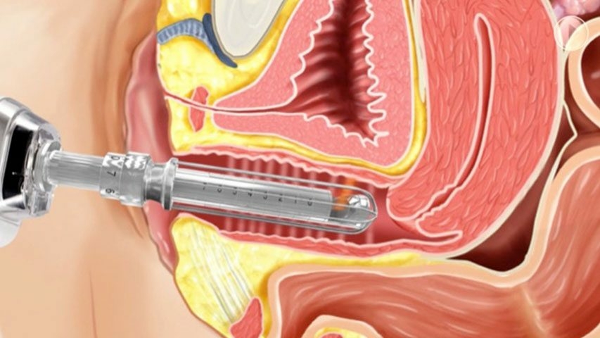آیا مونالیزا به اندام خصوصی ما آسیبی می رساند؟