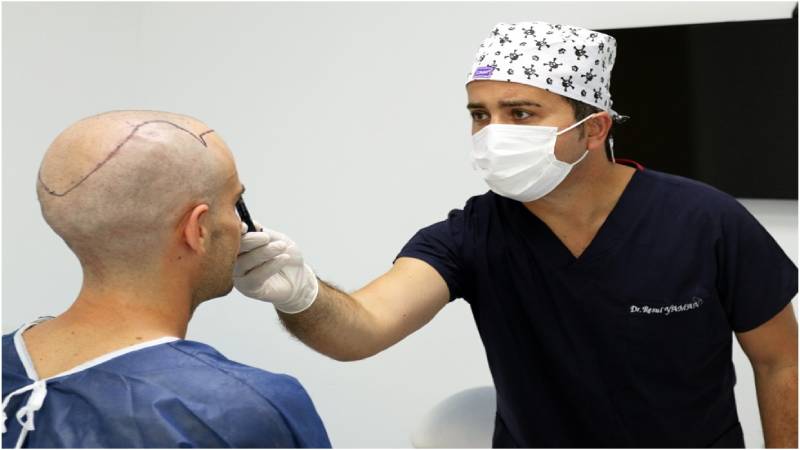 عوارض سیگار کشیدن پس از کاشت مو