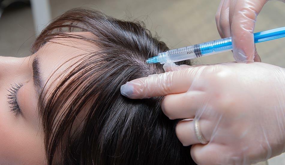 آیا انجام مزوتراپی مو درد دارد؟