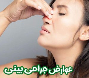 آیا جراحی زیبایی بینی ضرر دارد؟