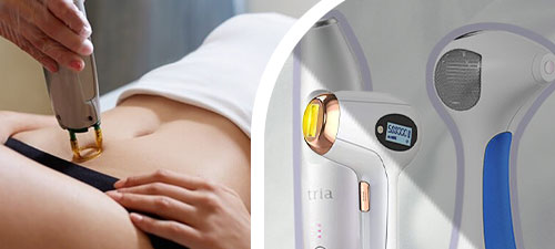 مزایای حذف موهای زائد با لیزر الکساندرایت