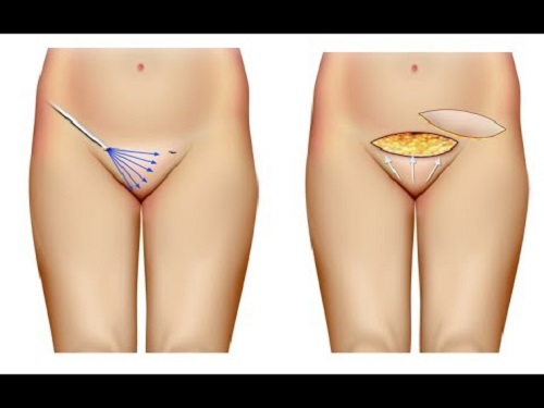 افزایش راحتی