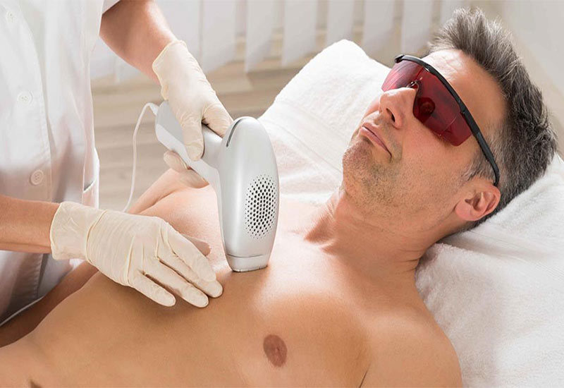 آیا بعد از لیزر نیاز به مراقبت خاصی هست؟