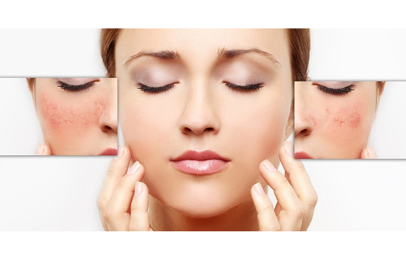 جوانسازی پوست صورت دغدغه امروز زیبا جویان