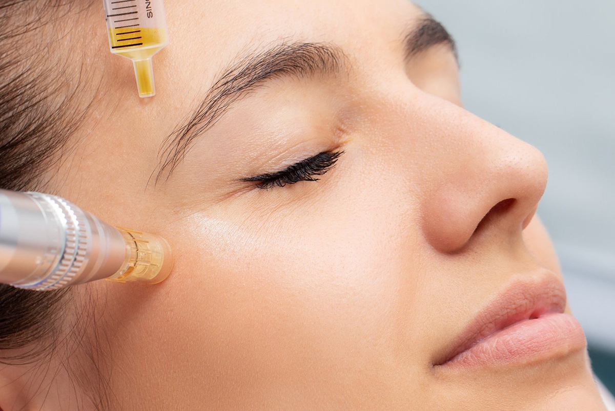 مهم ترین کاربردهای پی آرپی صورت