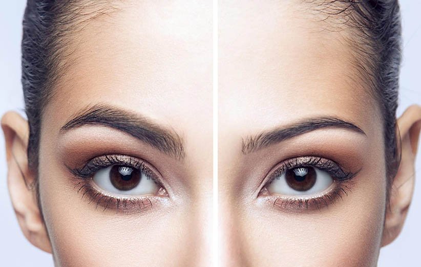 روش‌های افزایش رشد ابرو کدامند؟
