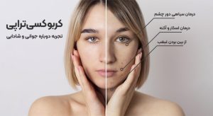 جوانسازی پوست با کروبوکسی تراپی