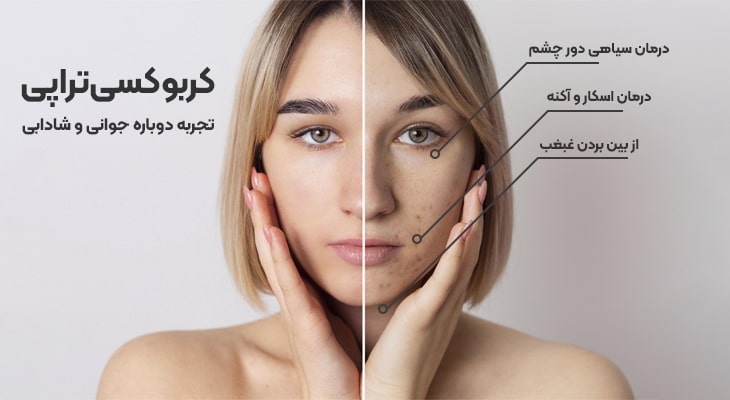 جوانسازی پوست با کروبوکسی تراپی