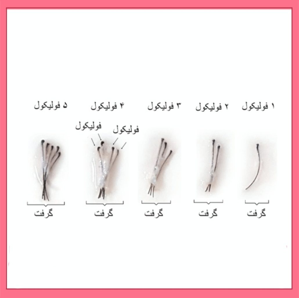 بانک مو و گرافت مو چیست ؟