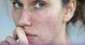 خطرات و عوارض میکرونیلدینگ