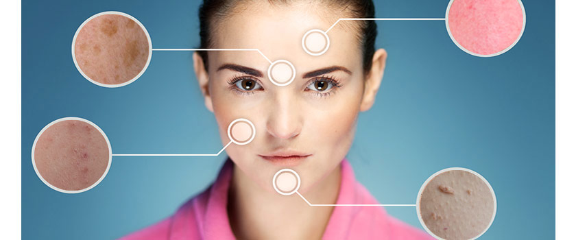 انواع بیماری پوستی راهی برای شناخت بدن