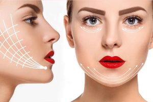 مراقبت های بعد از اندولیفت