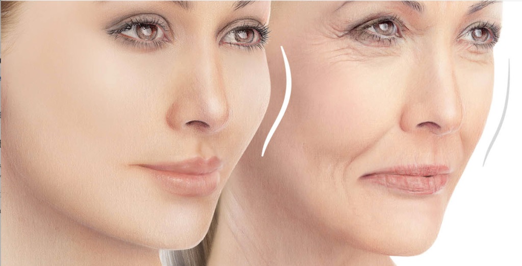 تزریق ژل+هزینه و معایب و مزایا