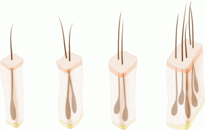 گرافت مو و بانک مو چیست؟