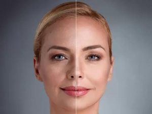 عوارض اندولیفت