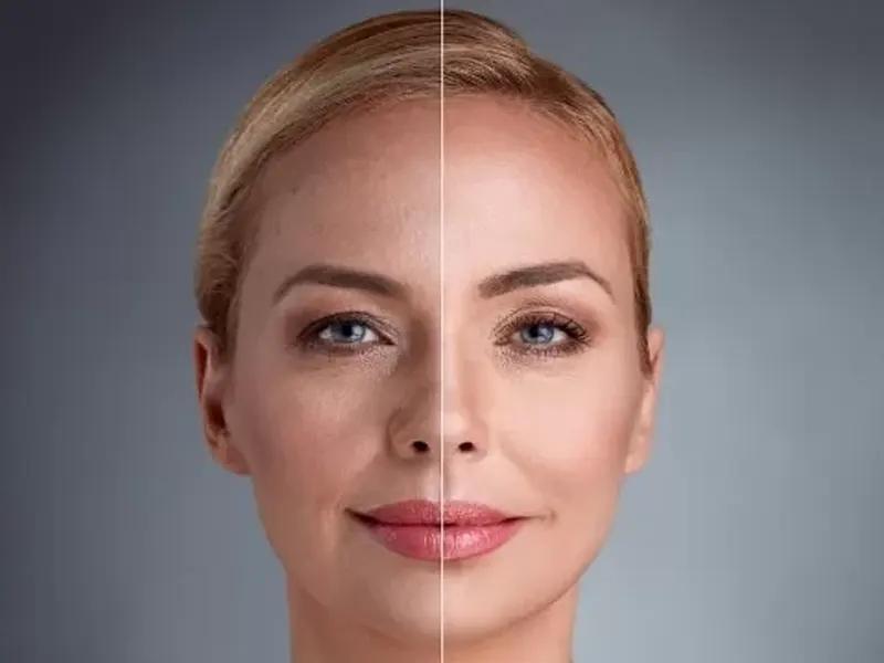 عوارض اندولیفت