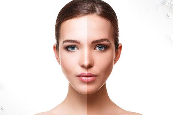 تیرگی پوست بعد از لیزر به چه دلیل است؟