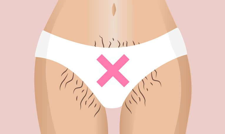 نکاتی جهت اینکه درمان لیزر بیکینی شما را کمتر خجالت آور کند