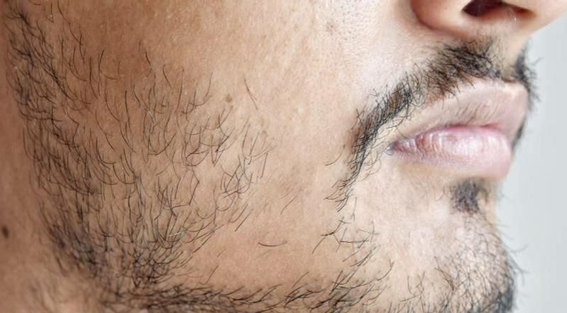 چه کسانی مجاز به انجام مزوی ریش نخواهند بود!