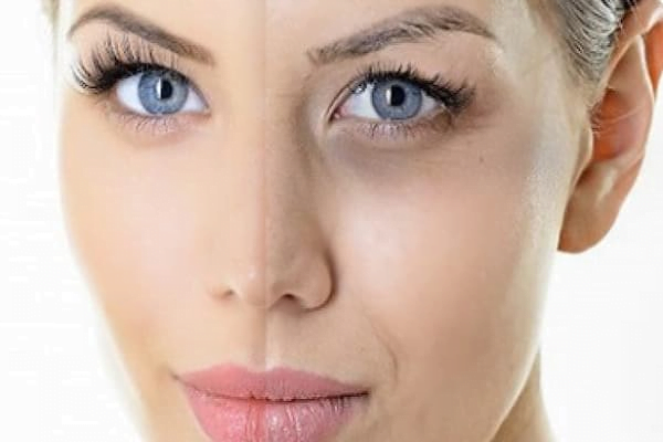 هزینه‌ تزریق ژل