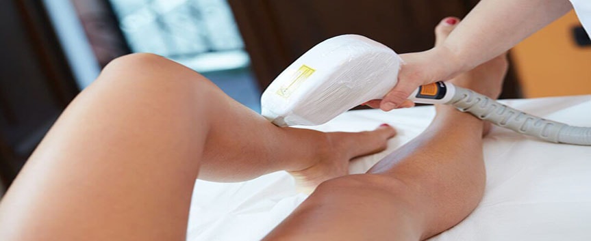 چگونه برای لیزر مو در دوران پریود آماده شوم؟